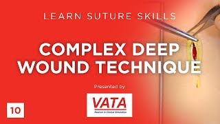 Complex Deep Wound Technique  Learn Suture Skills  VATA [upl. by Annoik511]