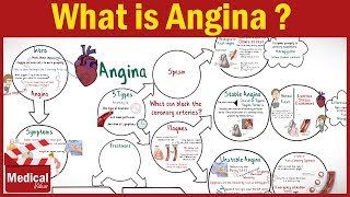 Pharmacology  What is Angina Pectoris  Types of Angina Symptoms Causes ampTreatment FROM A TO Z [upl. by Oidale450]