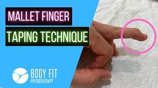 Mallet Finger I Taping Technique [upl. by Shaun]