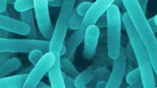 Update on foodborne listeria outbreaks [upl. by Eecart]