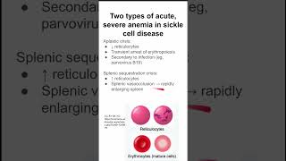 Two types of acute severe anemia in sickle cell disease [upl. by Krid]