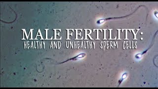 Male Fertility Healthy And Unhealthy Sperm Cells [upl. by Avrit]