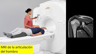 Imágenes por resonancia magnética MRI de la articulación del hombro [upl. by Colis768]