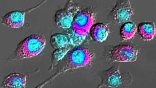 Imaging Macrophage Activation [upl. by Naxela]