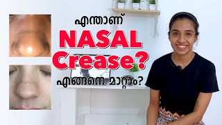 എന്താണ് Nasal Crease എങ്ങനെ മാറ്റാംTypesAllergyCreamsSerumsIngredientsPregnancy [upl. by Dibbrun926]