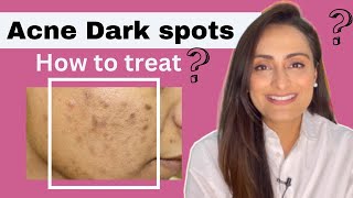 How To Remove DARK SPOTS From Face Naturally  ACNE SCARS BLACK SPOTS ACNE MARKS  Style Saiyan [upl. by Pacian]