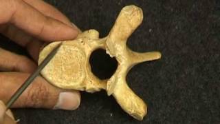 Osteology VivaVertebrae by Ghanashyam Vaidya [upl. by Isis]