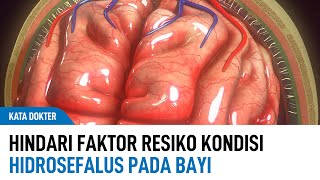 Calon Moms Hindari Faktor Resiko Terjadinya Kondisi Hidrosefalus Pada Bayi  Kata Dokter [upl. by Eidac479]