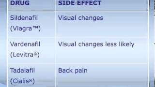 Medical Treatment of Erectile Dysfunction ED [upl. by Icat]