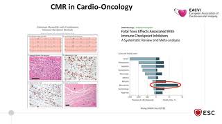 EACVI free webinar Highlights of EuroCMR 2019 [upl. by Keel997]