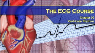 The ECG Course  Ventricular Rhythms [upl. by Anal]