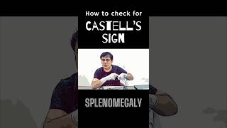 What is Castell’s sign in splenomegaly shorts splenomegaly spleenanatomy [upl. by Warwick]