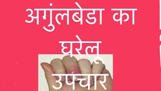 Angulbeda home remediesअंगुलबेडा घरेलू उपचार PARONYCHIA CURE [upl. by Phineas]