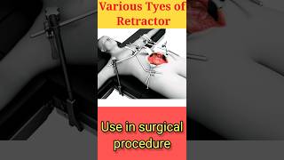 Instrument of the Day Surgical Retractors Types surgicalinstruments viral education neet [upl. by Ruby108]