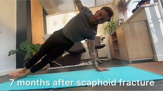 7 months after scaphoid fracture recovery update exercises progress [upl. by Cence306]