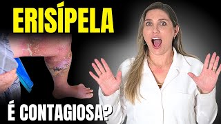 A ERISÍPELA É CONTAGIOSA [upl. by Bowra]