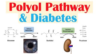 Polyol Pathway amp Diabetes  The Role of Polyol Pathway in Diabetes Pathogenesis [upl. by Ekud]