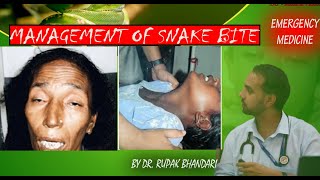 Emergency Medicine  Management of Snake Bite  Dr Rupak Bhandari [upl. by Vinnie961]