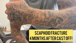 Scaphoid fracture recovery 4 Months progress and update [upl. by Frederigo]