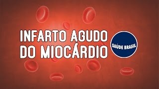 INFARTO AGUDO DO MIOCÁRDIO  SÉRIE SAÚDE BRASIL [upl. by Notnirb]