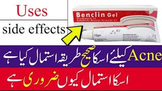 Benclin Gel Review  Benclin Gel Uses In Urdu Benzoyl Petoxide Benefits Uses [upl. by Enimassej692]