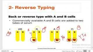 reverse blood grouping proceduretrick to remember [upl. by Fihsak]