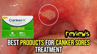 🌟 Banish Canker Sores FAST Top 3 Treatments Reviewed amp How to Use Them 🔥 [upl. by Eelyrag]