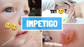 IMPETIGO  CAUSES  SYPMTOMES  COMPLICATIONS  TRAITEMENT [upl. by Revolc]