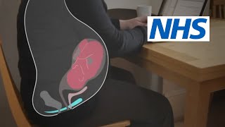 How and when should I do pelvic floor exercises  NHS [upl. by Eilrac472]