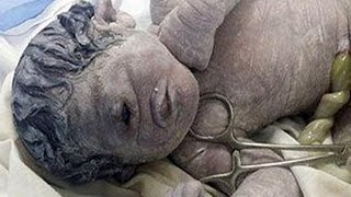 Cyclops Baby Born In Egypt [upl. by Gavriella]