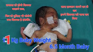 Preterm baby boy with 1 kg weight  cute viral viralvideo doctor medical shorts [upl. by Asoj]