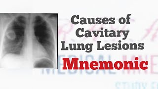 Causes of Cavitary Lung Lesions  Mnemonic quotCAVITARYquot for all causes of lung cavities  MedSurvival [upl. by Gebhardt540]