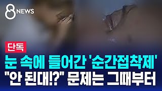 단독 눈 속에 들어간 순간접착제…quot안 된대quot 문제는 그때부터  SBS 8뉴스 [upl. by Kenimod247]