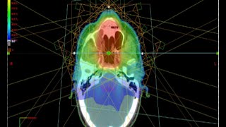 RTU MS Medical Dosimetry [upl. by Nolasba]