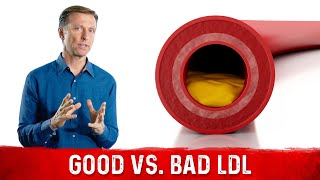 You Have Good and Bad LDL lowdensity lipoprotein [upl. by Leinahtam605]