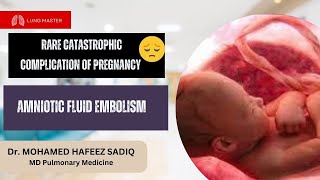 Amniotic Fluid Embolism [upl. by Heim]