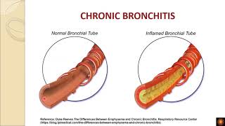 Pinene amp Limonene  Two terpenes that aid with respiratory issues including bronchitis [upl. by Nabalas]