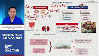 12 Endocarditis infecciosa [upl. by Saidel]