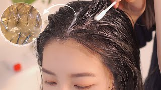 ASMR 시원한 두피 마사지스케일링빗질  Scalp Massage and Scalp Scaling [upl. by Paterson888]