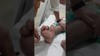 Upgoing plantar reflex positive Babinskis test [upl. by Noswad]