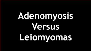 Adenomyosis Versus Leiomyomas on Ultrasound [upl. by Dnomyar]