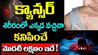 క్యాన్సర్ శరీరంలో ఎక్కడ వచ్చినా కనిపించే మొదటి లక్షణం ఇదేCancer Disease Symptoms In Telugu tumore [upl. by Nitniuq]