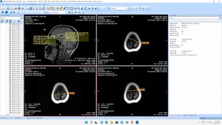 How to copy a DICOM image to clipboard [upl. by Lateehs]