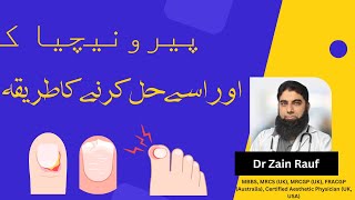 What is PARONYCHIA Its a nail infection  Solve Paronychia  In Urdu [upl. by Atileda]