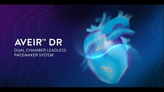 AVEIR DR™ Dual Chamber Leadless Pacemaker System 3D Implantation Simulation [upl. by Ikram]