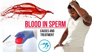 Blood in Sperm  HEMATOSPERMIA  Causes And Treatment [upl. by Aicinat]