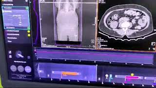 Aortogram Ct scan how to do the scan in CT machine [upl. by Doone962]