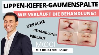 Wie behandelt man eine Lippen Kiefer Gaumenspalte  9 Fragen an Dr Daniel Lonic  MOOCI [upl. by Dlawso216]