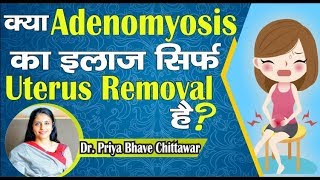 Adenomyosis and Pregnancy Success  Adenomyosis Symptoms Causes and Treatment [upl. by Imotih345]