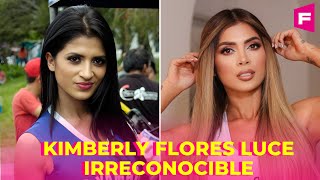 Kimberly Flores quería ser una Barbie todas las cirugías que se ha realizado [upl. by Enneirdna]